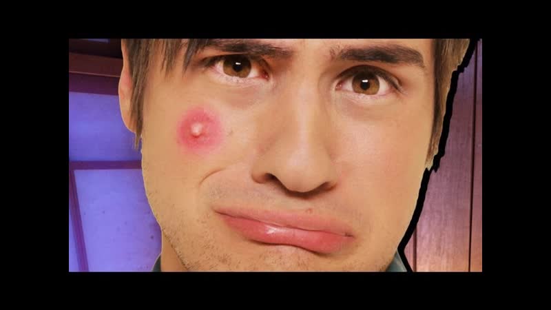 BIGGEST ZIT
