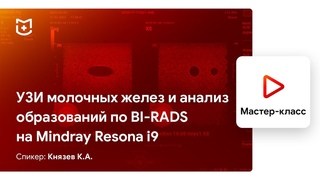 УЗИ молочных желез и анализ образований по BI-RADS на Mindray Resona i9