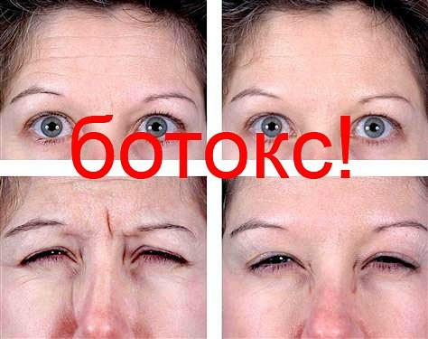 Виктория Ким | Киев