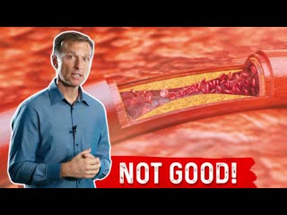 This Is What Sugar Does to Your Arteries